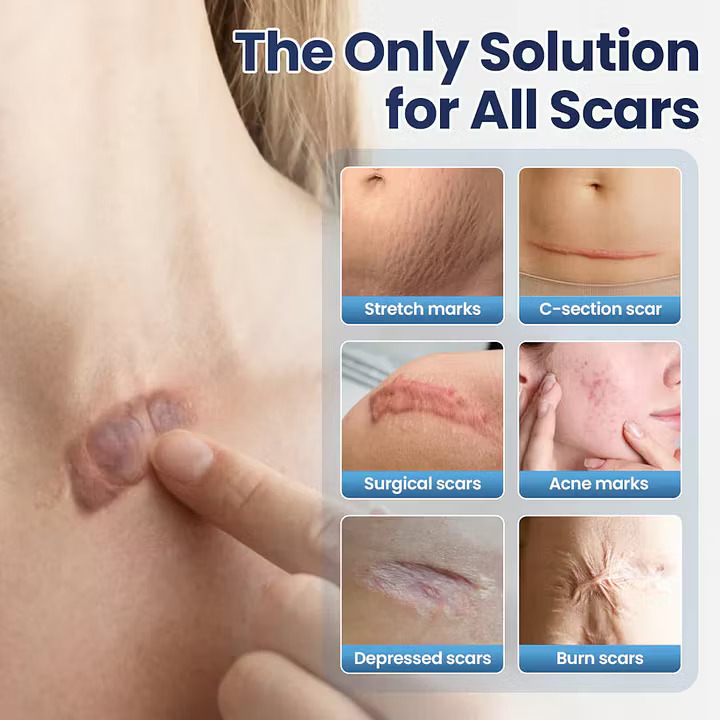 LAOZIK® Texture Repair Gel - Image 3