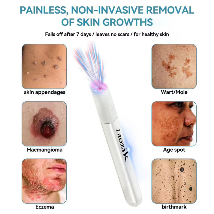 LAOZIK™ All-in-One CO₂ Laser Eraser Pen - Image 2