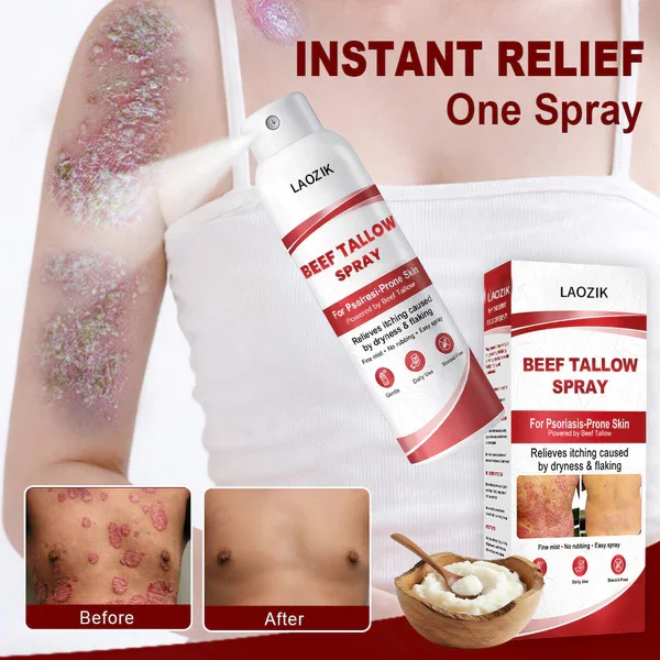 LAOZIK® Beef Tallow Spray for Itchy, Flaky Psoriasis Skin - Image 4